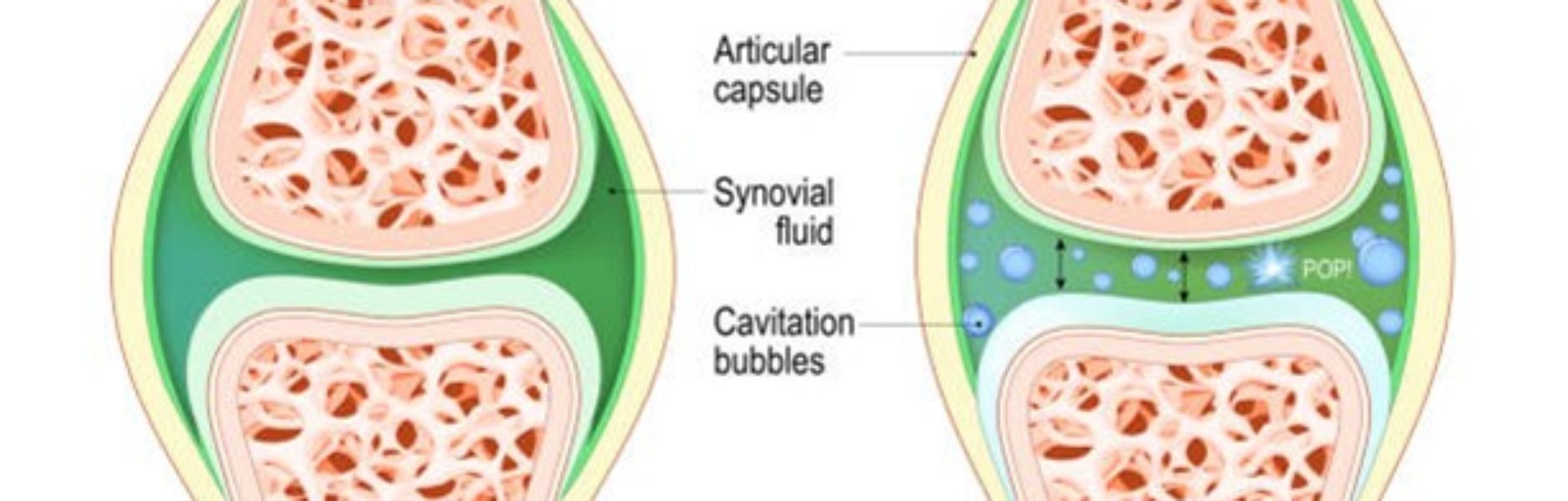 Does the ‘Pop’ or ‘Crack’ Matter?